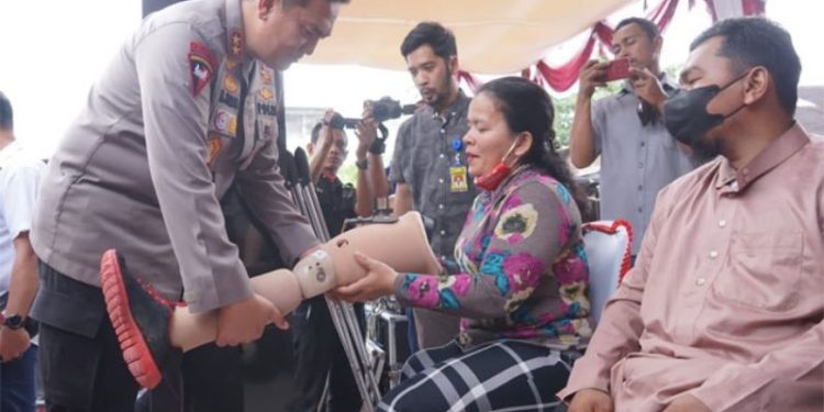 Beri Kaki Palsu untuk Penyandang Disabilitas, Kapolda: Inilah Konsep Presisi