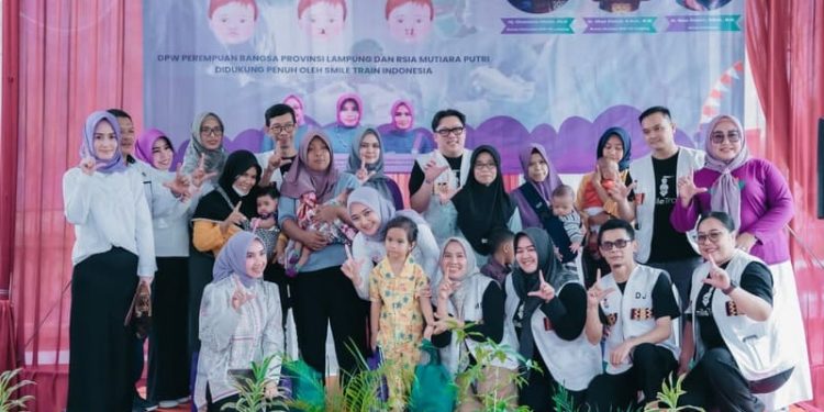 Pemprov Lampung Apresiasi Bakti Sosial Operasi Bibir Sumbing Gratis